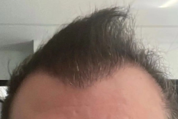 04-1